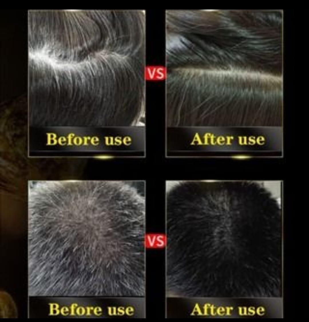 Unisex Instant Black Herbal Hair Dye Shampoo – Grey Hair Coverage 3-in-1 (100ml) Pack of 2