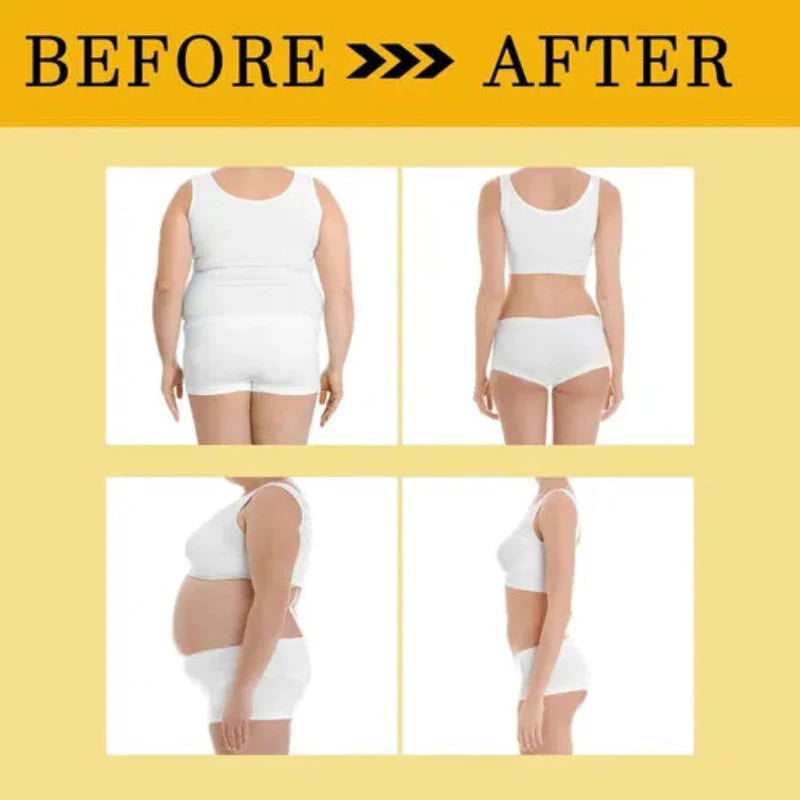 Slimming Belly Patches (BUY 1 GET 1 FREE)