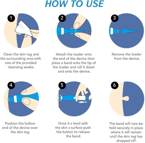 2 in 1 Skin Tag Remover Kit - Painless - Style Elevates