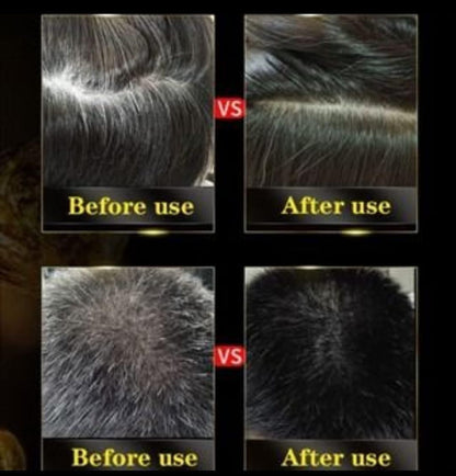 Unisex Instant Black Herbal Hair Dye Shampoo – Grey Hair Coverage 3-in-1 (100ml) Pack of 2
