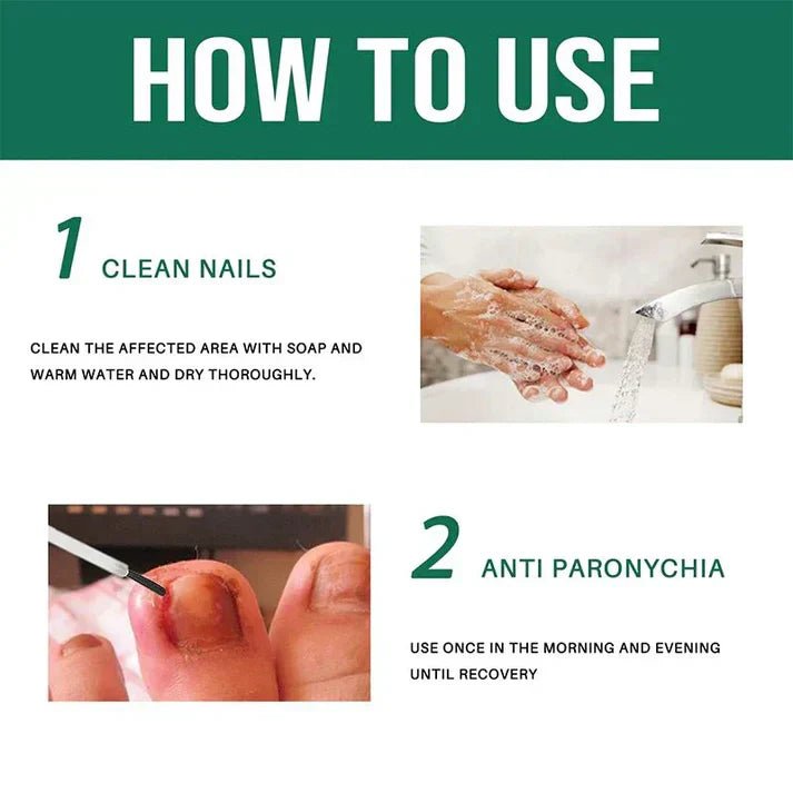 Anti-Paronychia Nail Relief Oil 🔥 - Style Elevates