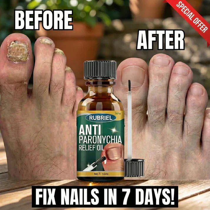 Anti-Paronychia Nail Relief Oil 🔥 - Style Elevates