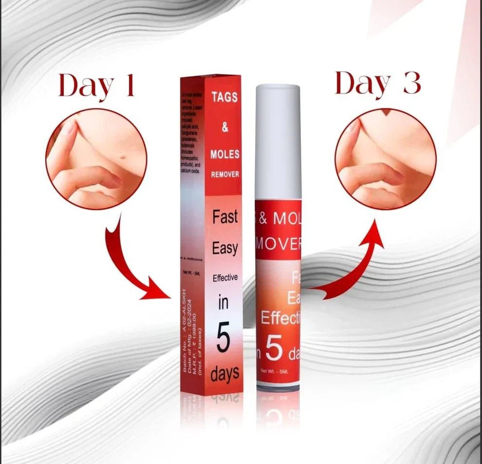Ayurcare™ tags & mole remover - Style Elevates