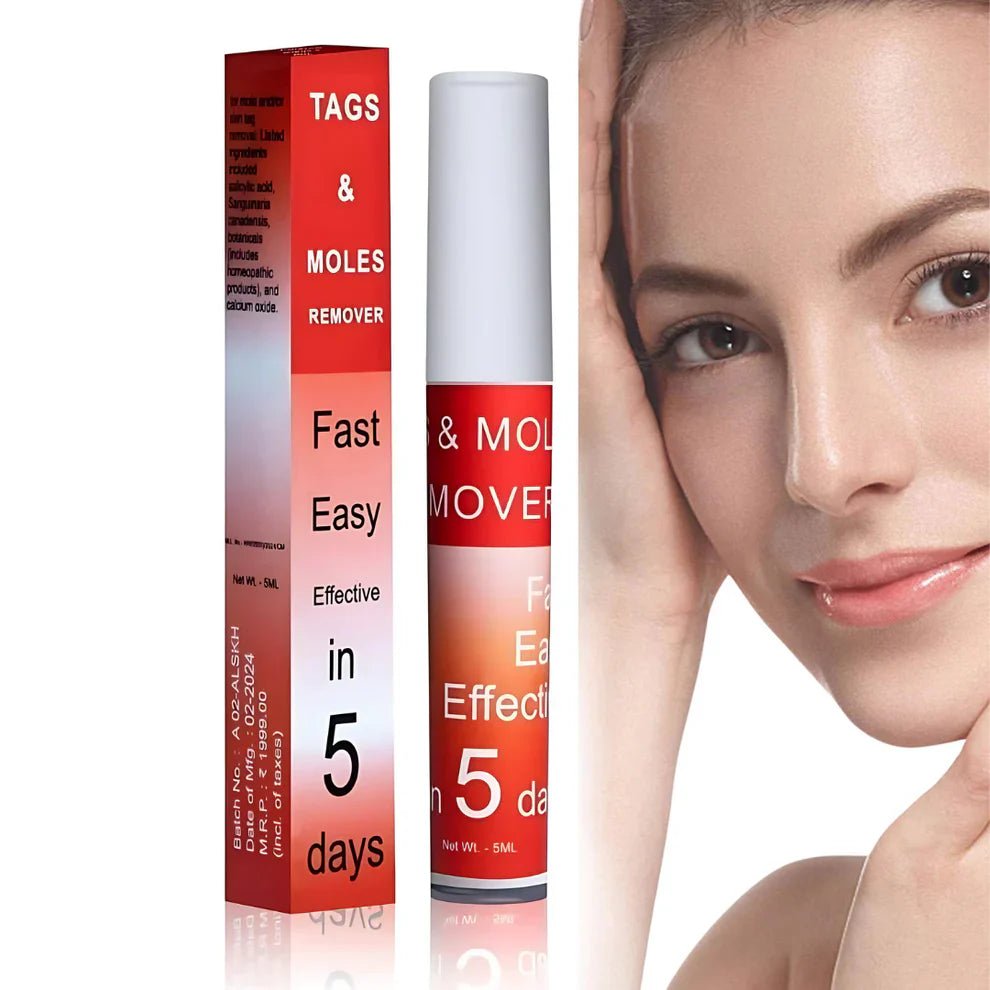 Ayurcare™ tags & mole remover - Style Elevates