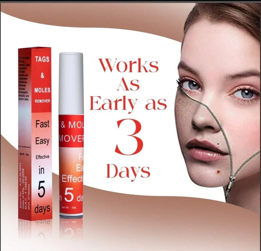 Ayurcare™ tags & mole remover - Style Elevates