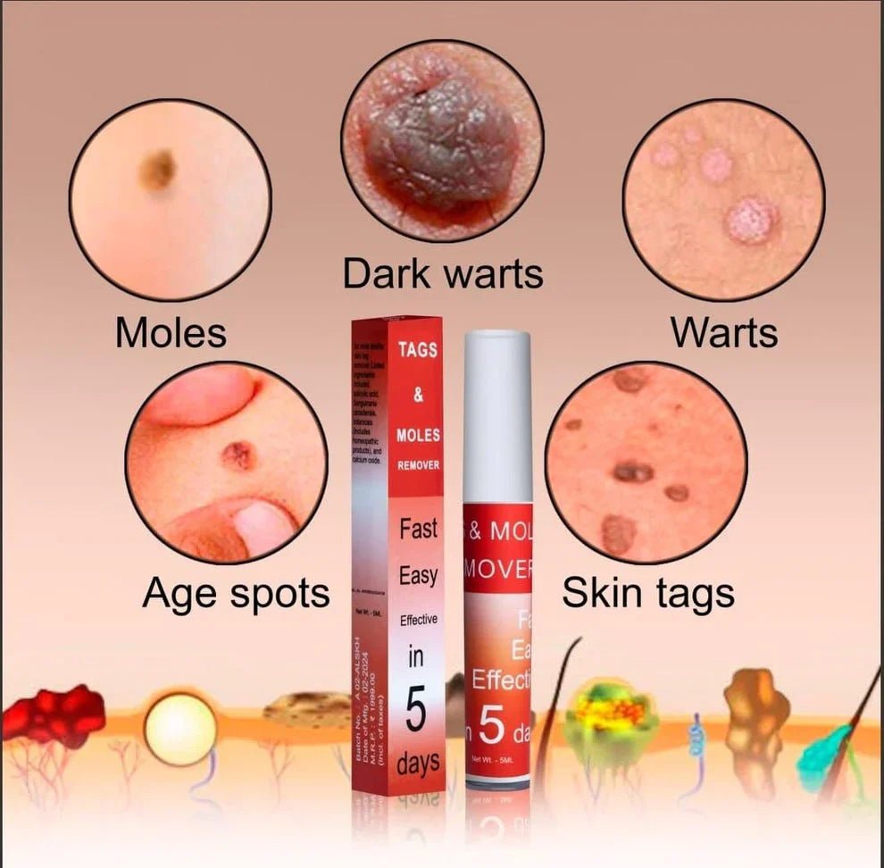 Ayurcare™ tags & mole remover - Style Elevates