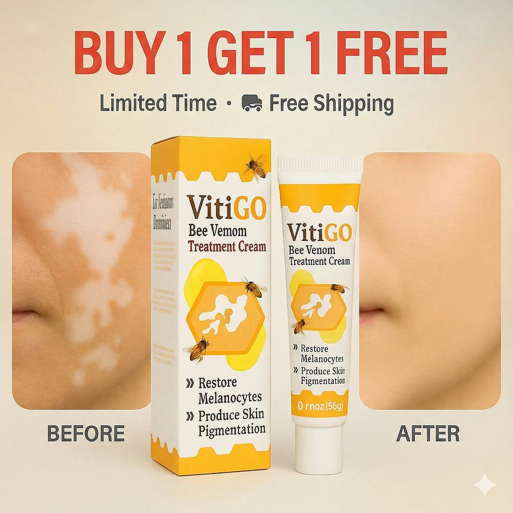 Bee Venom Vitigo Correcting Cream - (Pack of 2) - Style Elevates