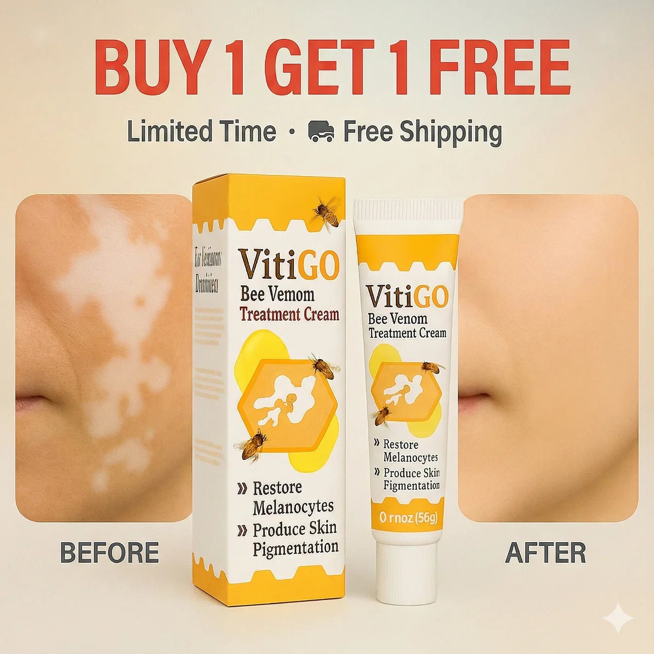 Bee Venom Vitigo Correcting Cream - (Pack of 2) - Style Elevates