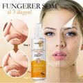 Bee Venom Wart Remover Spray 30ml - Style Elevates