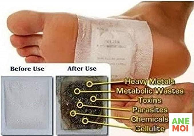Detox Foot Patches (Set of 10) - Style Elevates