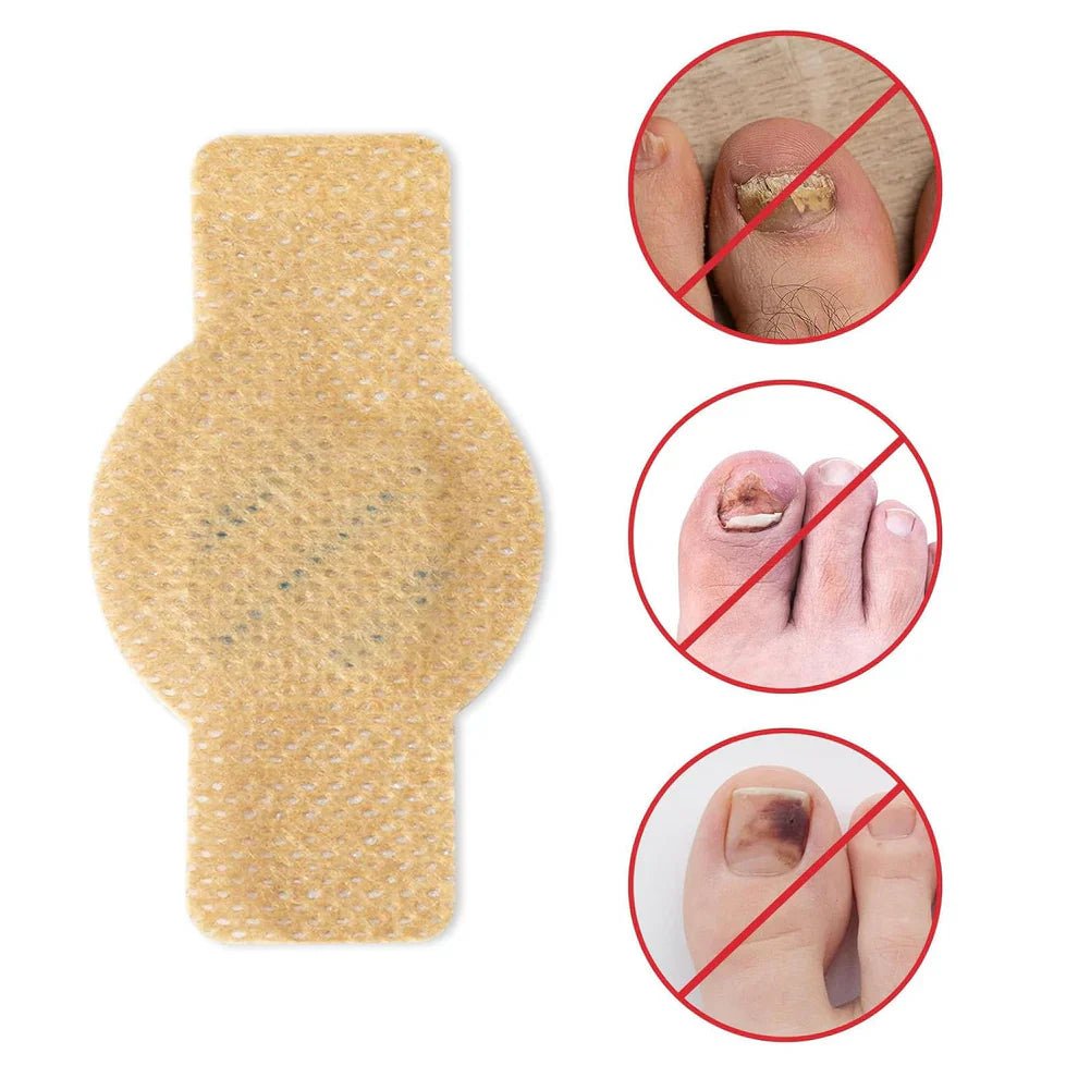 NailHeal™ - Fungal Nail Patches - Style Elevates