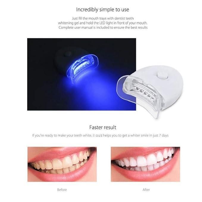 Teeth Cleaning & Whitening Kit - Style Elevates