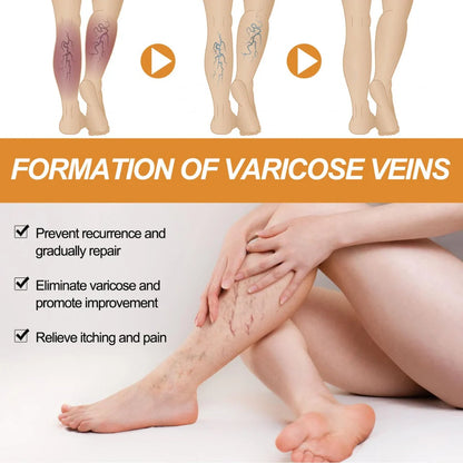 Varicose Veins Treatment Spray(Buy 1 Get 1 Free)